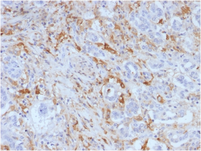 Anti-Ferritin Light Chain Antibody [FTL/1388]