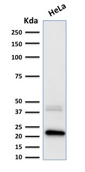 Anti-Ferritin Light Chain Antibody [FTL/1389]