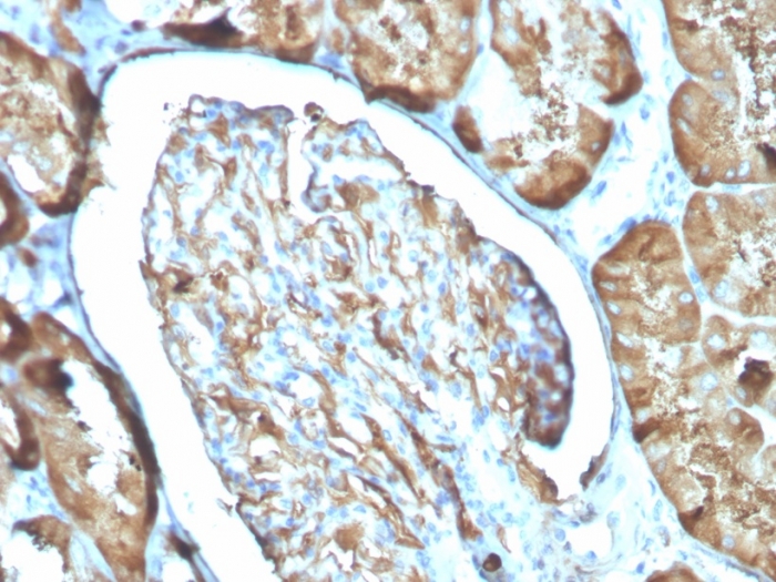 Anti-Ferritin Light Chain Antibody [FTL/3100]