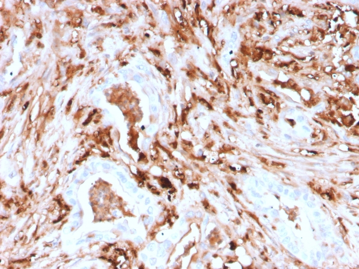 Anti-Ferritin Light Chain Antibody [rFTL/1388]