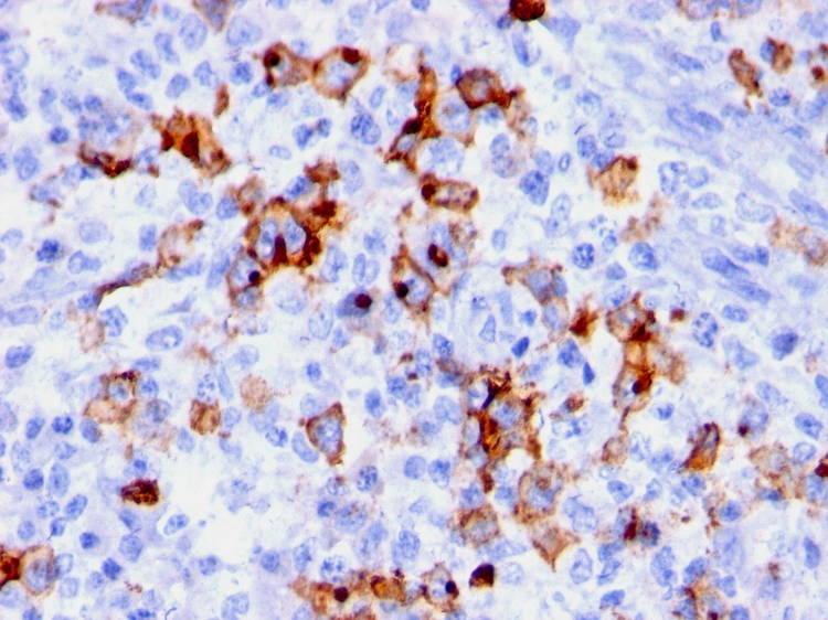 Anti-CD15 Antibody [BRA-4F1]