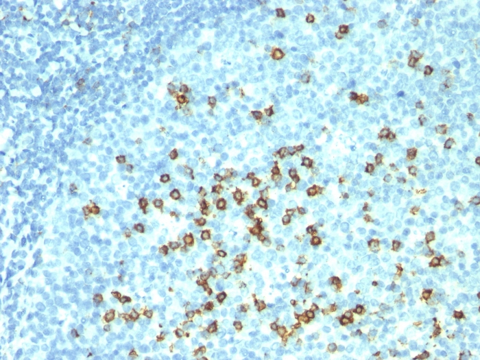 Anti-CD57 Antibody [HNK-1 + NK-1]