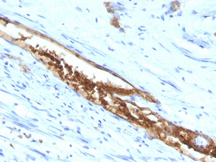 Anti-Blood Group Antigen A Antibody [3-3A]