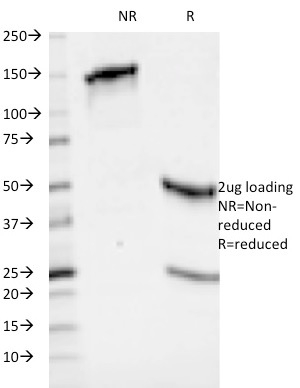 Anti-HLA ABC Antibody [246-B8.E7]