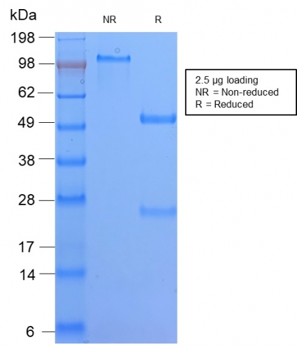 Anti-HLA DQ Antibody [HLA-DQA1/2866R]