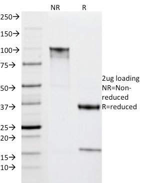 Anti-HLA DRA Antibody [IPO-10]