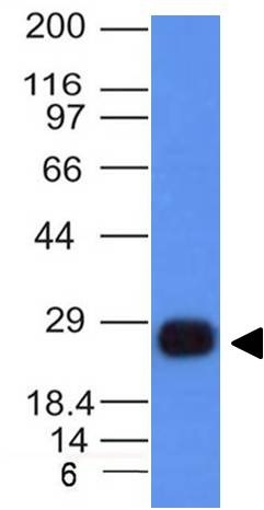 Anti-HLA DRB Antibody [HLA-DRB/1067]