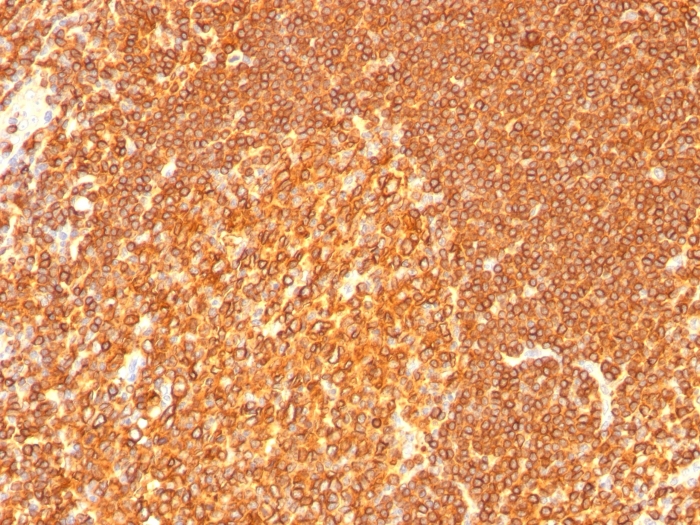 Anti-HLA DRB Antibody [LN-3 + HLA-DRB/1067]