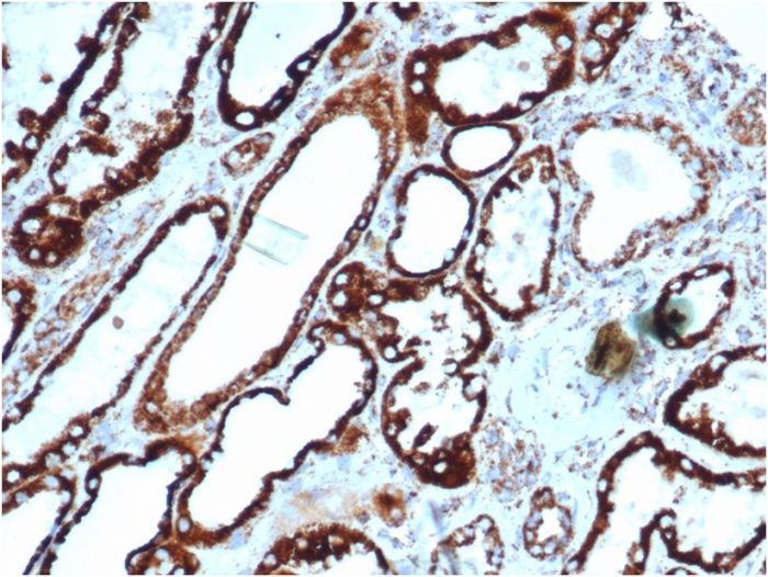 Anti-HSP60 Antibody [rHSPD1/6495]