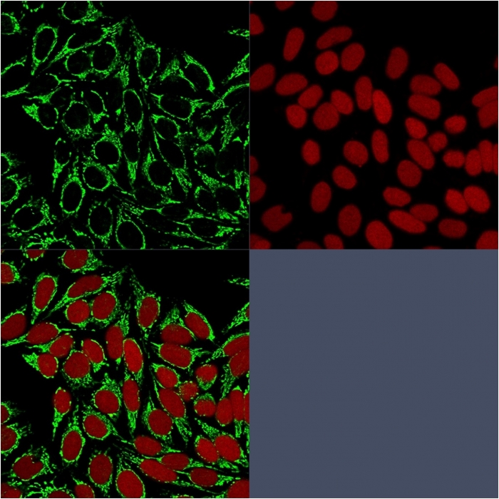 Anti-HSP60 Antibody [HSPD1/875]