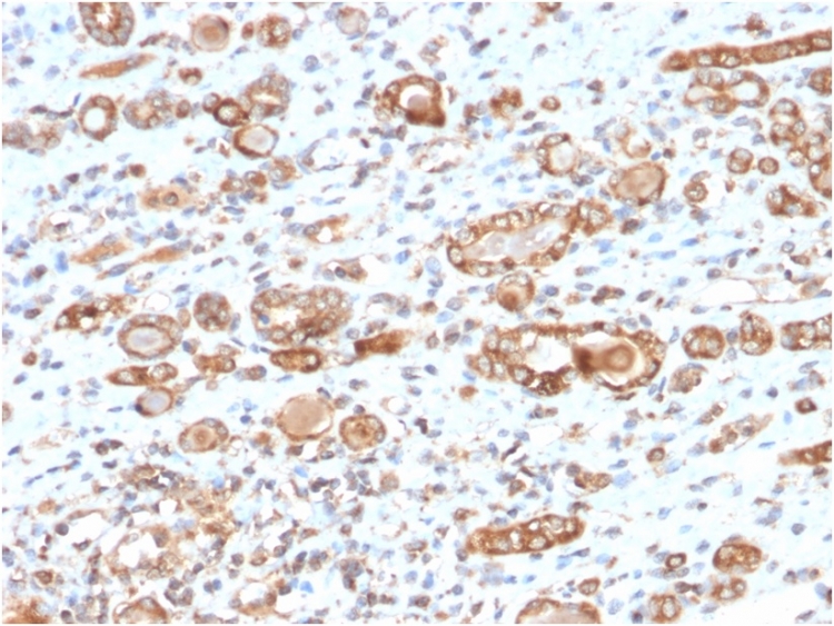 Anti-HSP60 Antibody [CPTC-HSPD1-1]