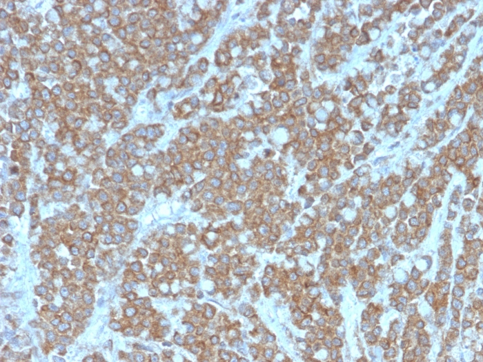 Anti-IL-1 alpha Antibody [IL1A/3981]