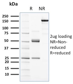 Anti-c-Kit Antibody [KIT/2672]