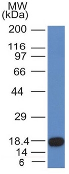 Anti-c-Kit Antibody [KIT/982]