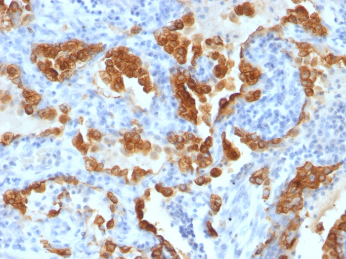 Anti-Cytokeratin 8 Antibody [H1 + TS1]