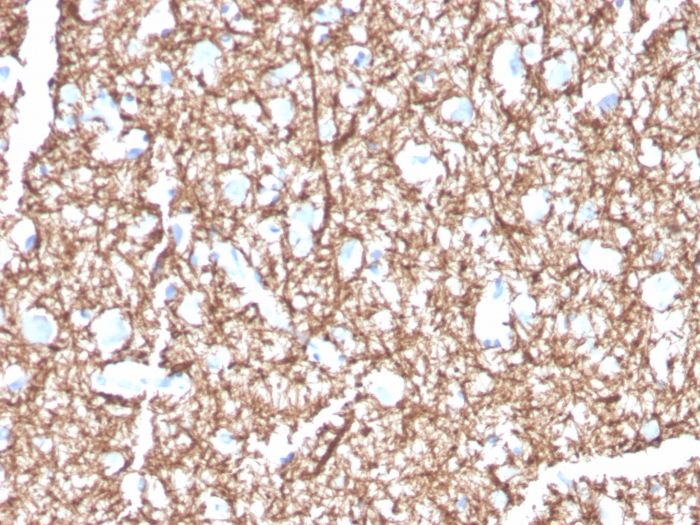 Anti-Myelin Basic Protein Antibody [MBP/4271]