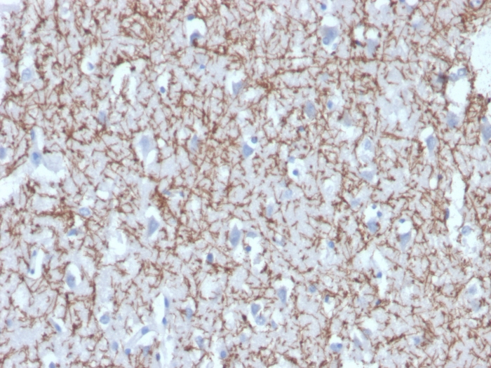 Anti-Myelin Basic Protein Antibody [MBP/4272]