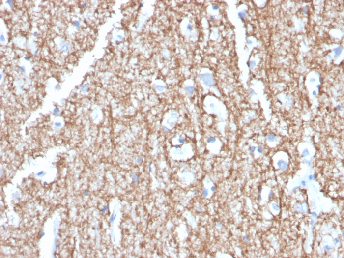 Anti-Myelin Basic Protein Antibody [MBP/4273]