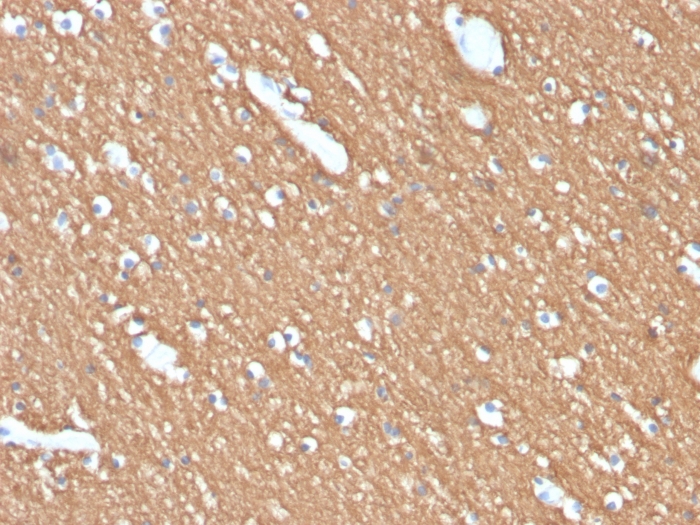 Anti-Myelin Basic Protein Antibody [MBP/4274]