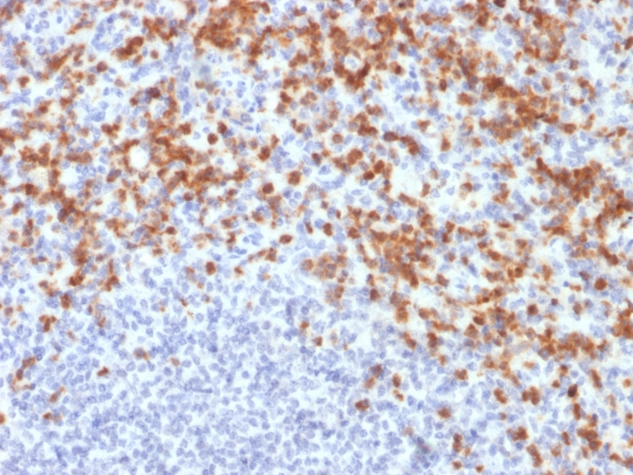 Anti-MMP9 Antibody [MMP9/2477]