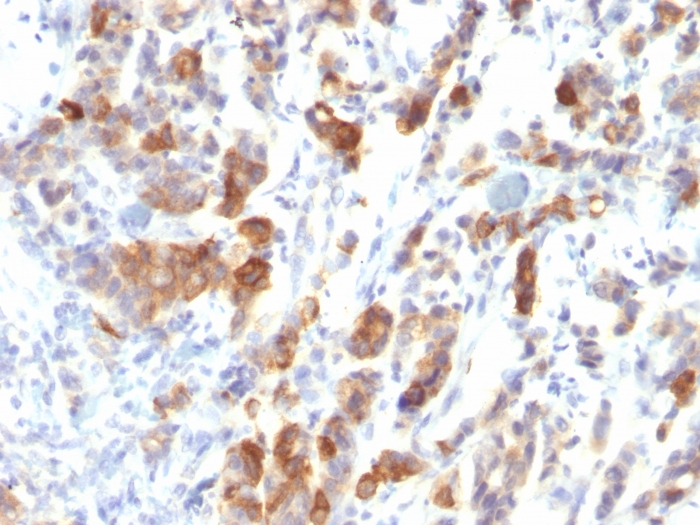 Anti-Mucin 5AC Antibody [MUC5AC/917]