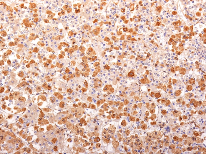 Anti-ACTH Antibody [AH26 + 57]