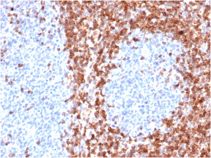 Anti-Bcl-2 Antibody [BCL2/6426R]