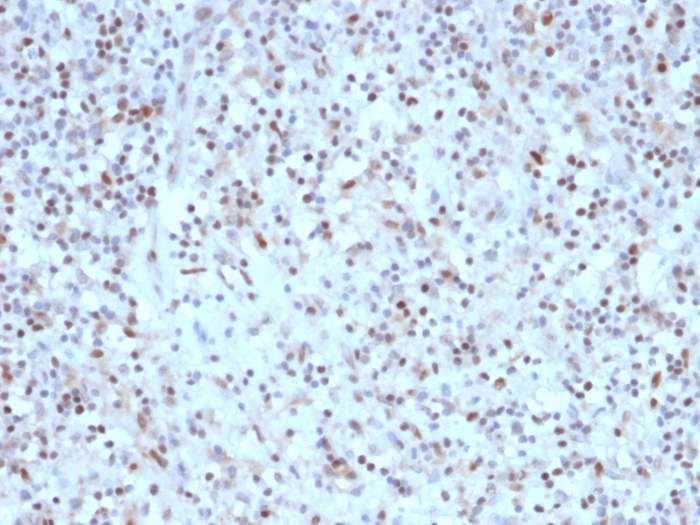 Anti-Bcl-6 Antibody [rBCL6/1527]