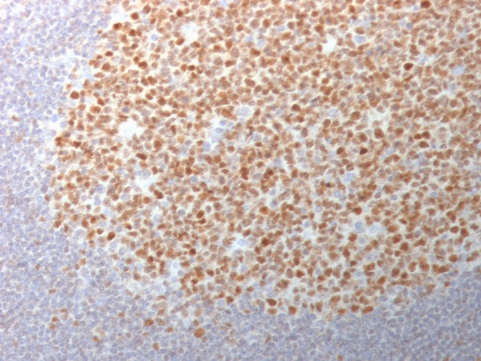 Anti-Bcl-6 Antibody [BCL6/1982]