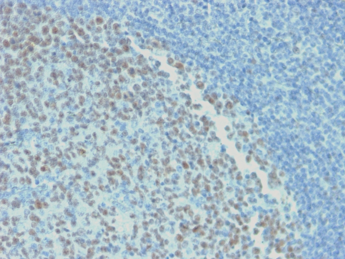 Anti-Bcl-6 Antibody [rBCL6/1718]