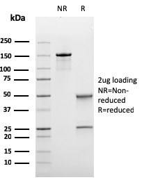 Anti-Bcl-6 Antibody [rBCL6/1475]