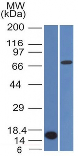 Anti-Bcl-6 Antibody [BCL6/1475]