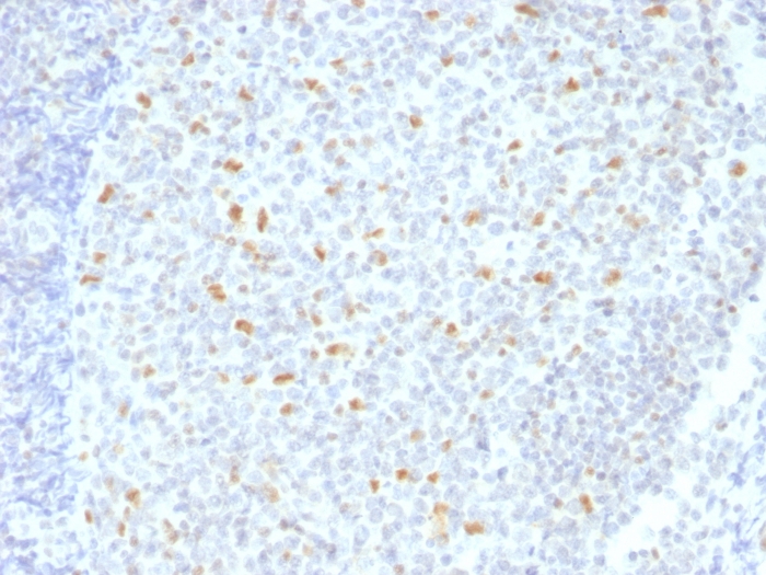 Anti-Bcl-6 Antibody [BCL6/1526]