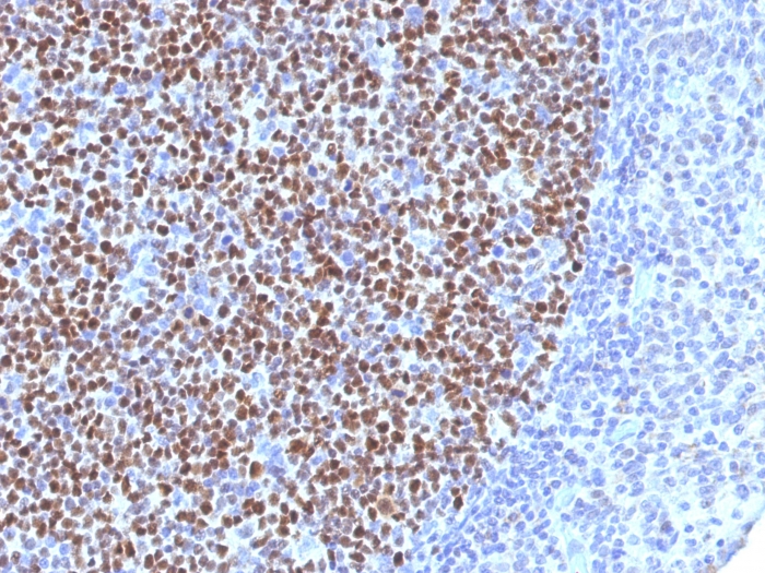 Anti-Bcl-6 Antibody [BCL6/1527]