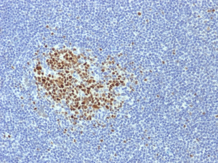 Anti-Bcl-6 Antibody [BCL6/1718]