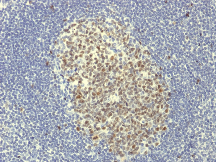 Anti-Bcl-6 Antibody [BCL6/1951R]