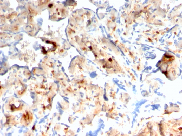 Anti-S100A4 Antibody [rS100A4/1481]