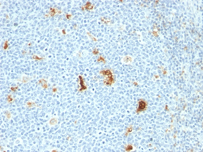 Anti-Macrophage L1 Protein Antibody [SPM281]