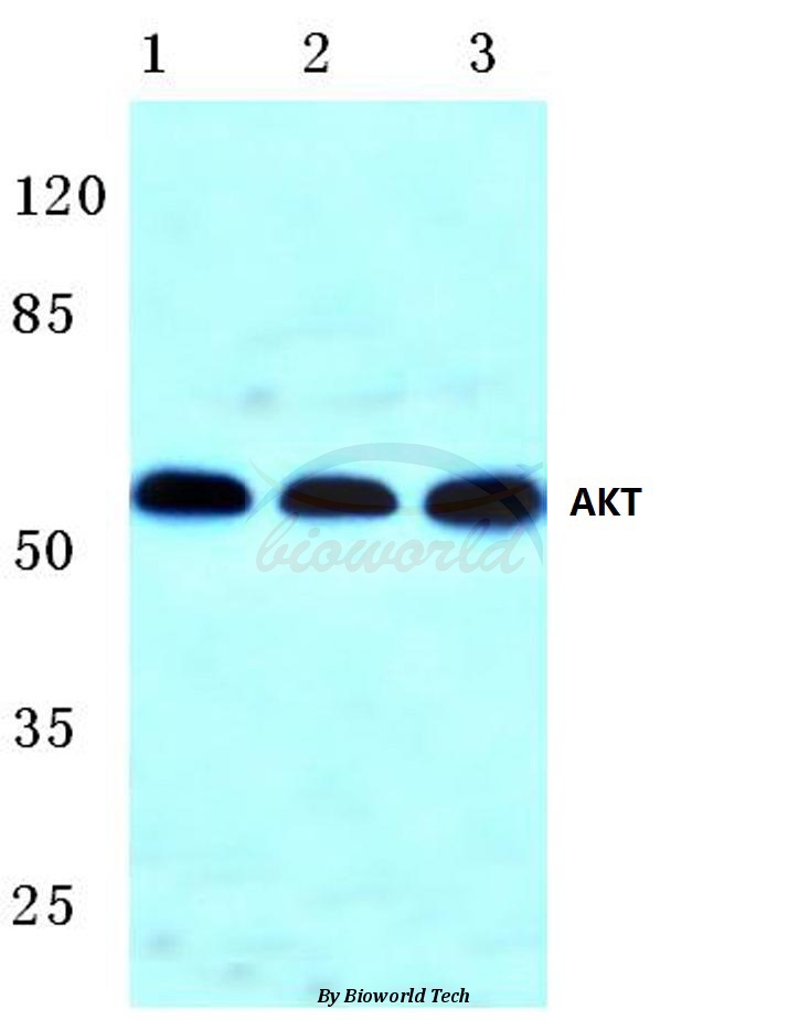 Anti-AKT (F469) Antibody