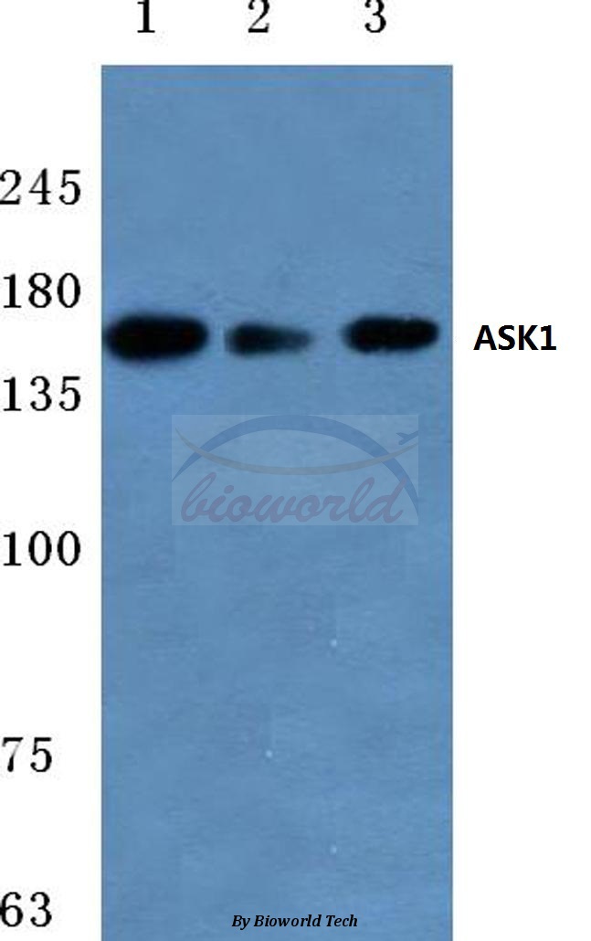 Anti-ASK1 (T77) Antibody