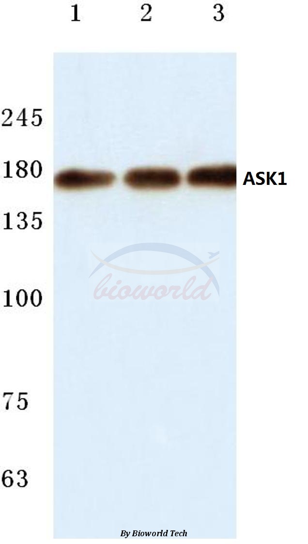 Anti-ASK1 (E960) Antibody