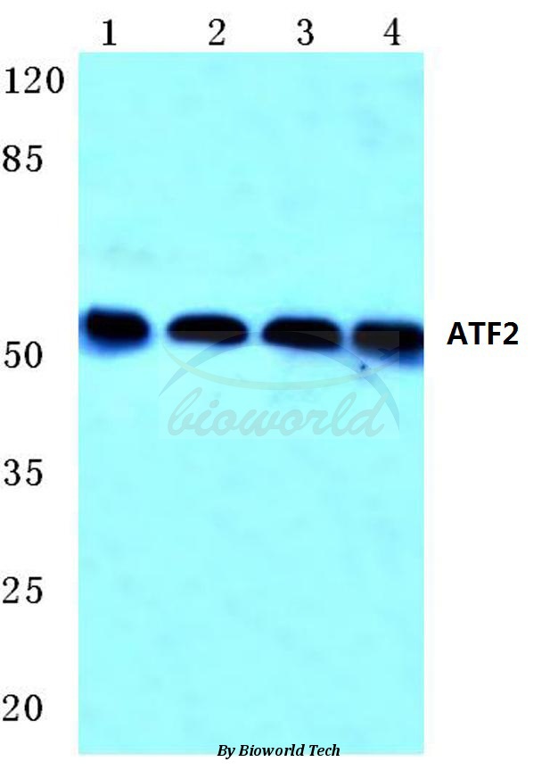 Anti-ATF2 (G56) Antibody