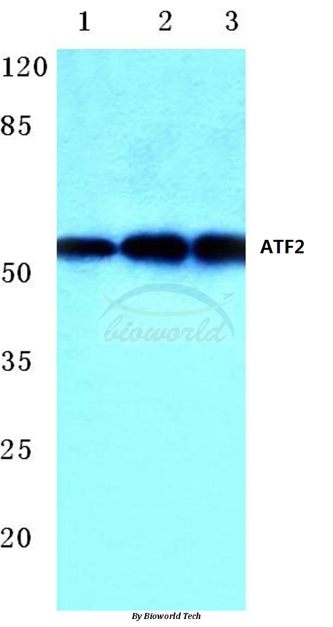 Anti-ATF2 (V63) Antibody