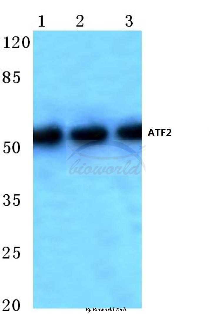 Anti-ATF2 (V65) Antibody