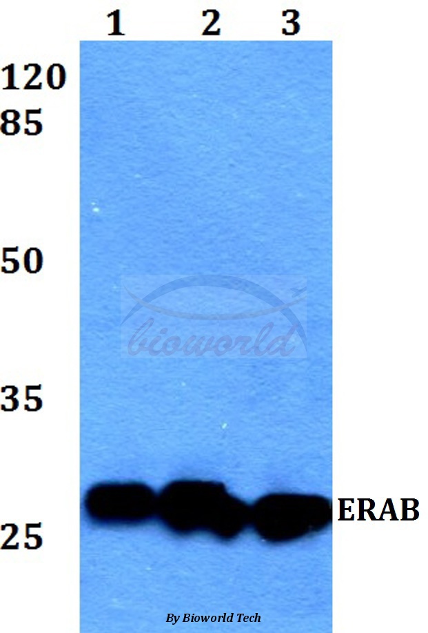 Anti-ERAB (E135) Antibody