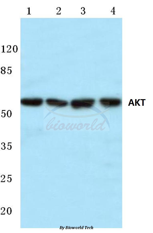 Anti-AKT (P470) Antibody