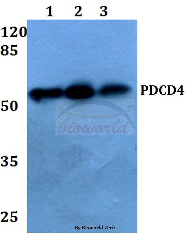 Anti-PDCD4 (K453) Antibody