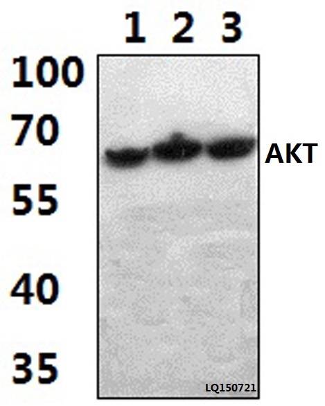 Anti-AKT (A444) Antibody