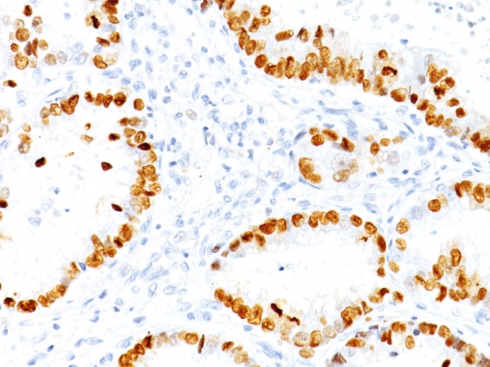 Anti-TTF1 Antibody [NX2.1/690]