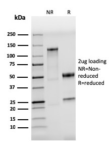 Anti-TLR4 Antibody [TLR4/3895R]